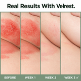 Velrest. Intertrigo Relief Cream