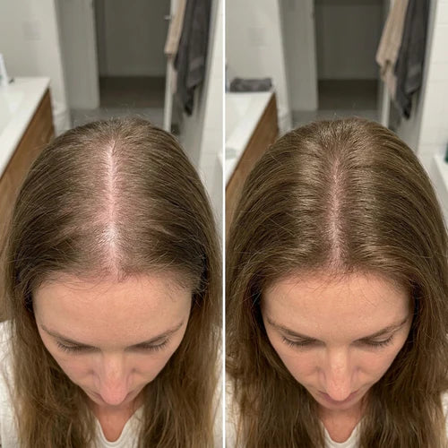Olivia, 36