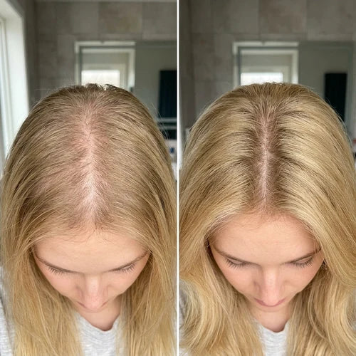 Emily, 35